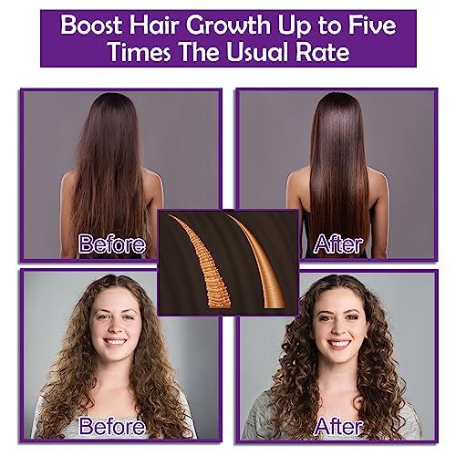 Hair Growth Shampoo and Conditioner Set With Rosemary, Biotin, Argan, and Castor Oils for Thinning, Damaged, Curly Hair