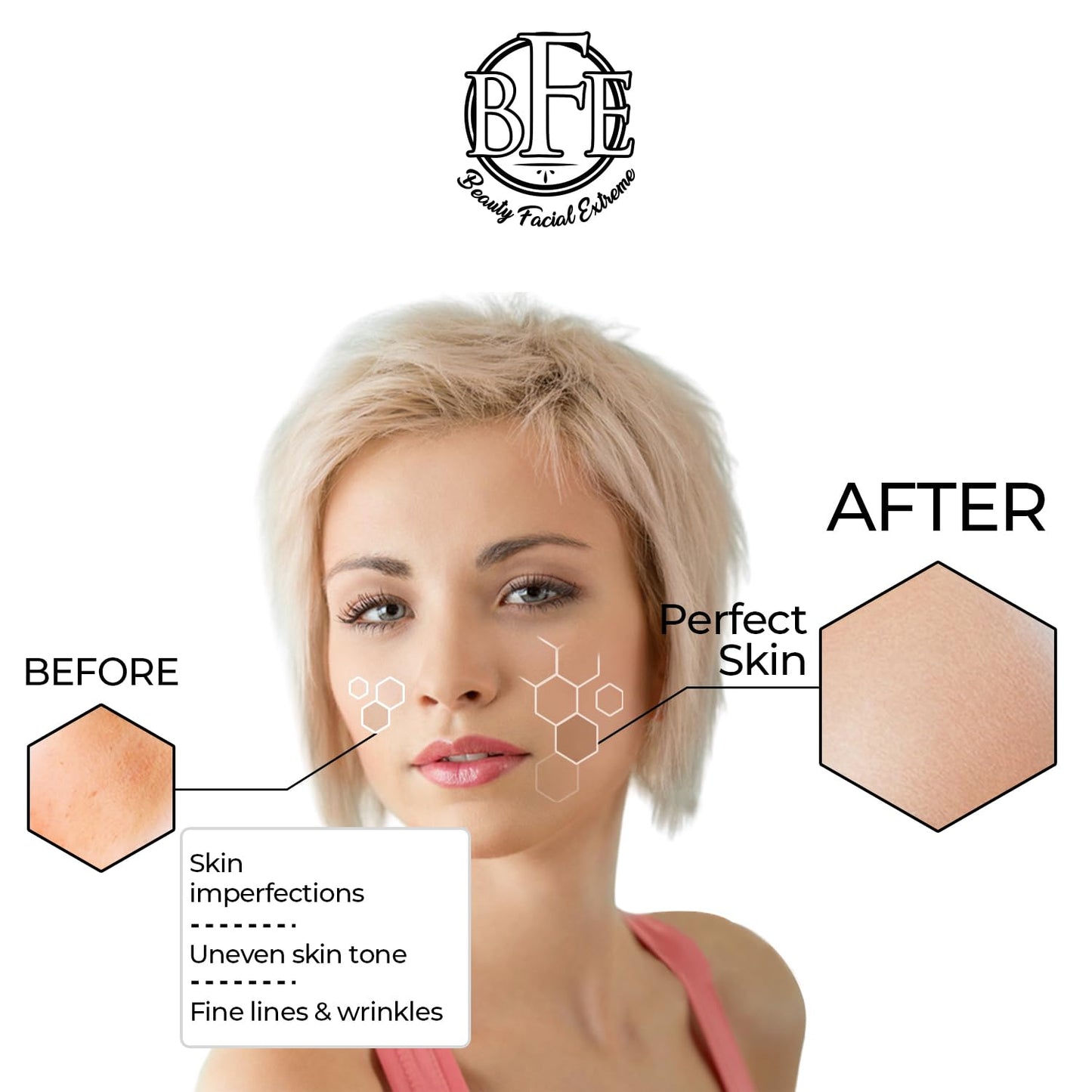 Anti Aging Resurfacing Exfoliating Peel Pads Treatment- Contains Lactic, Salicylic, & Glycolic for Face & Body. Repairs Fine Lines, Wrinkles, Dark Spots, Pores, Acne Scars & Uneven Skin Tone.