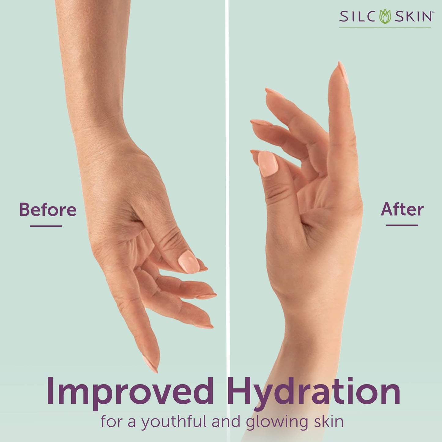 SilcSkin Hand & Body Treatment - Water-Based Hand & Body Lotion for Crepey Skin and Fine Lines - Uses Medical Grade Silicone for Deep Hydration - 4 oz