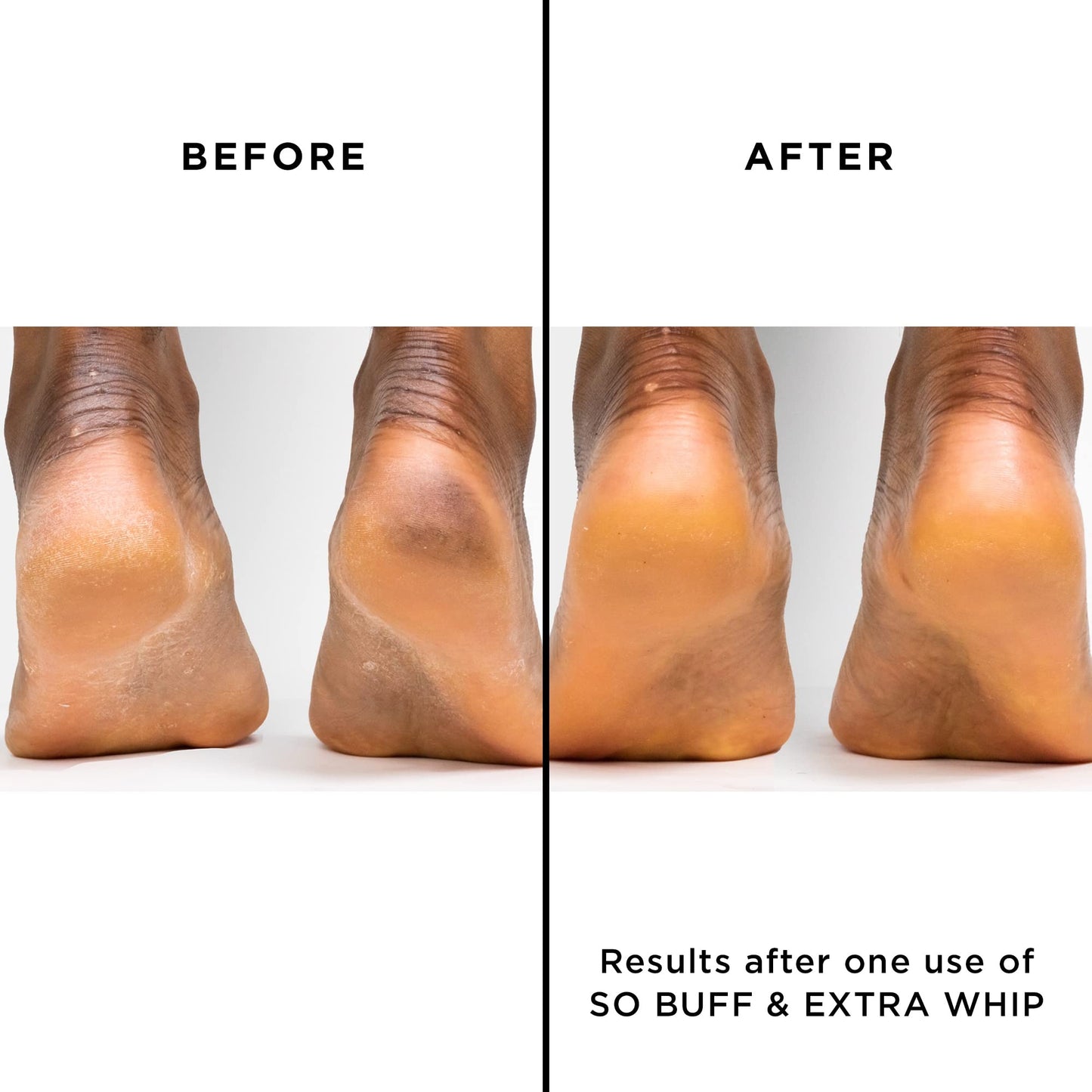 butter LONDON Extra Whip Hand & Foot Treatment, Shea & Cocoa Butter, Helps Hydrate & Restore Dry Skin, Helps Firm Skin’s Appearance, Vegan, Cruelty & Paraben Free